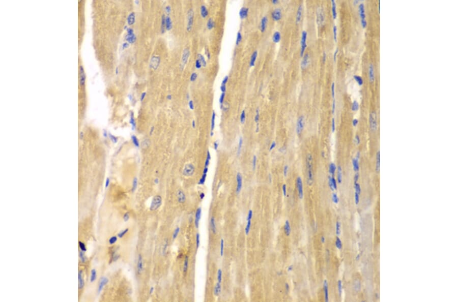 Immunohistochemistry - Anti-SLC25A13 Antibody (A5849) - Antibodies.com