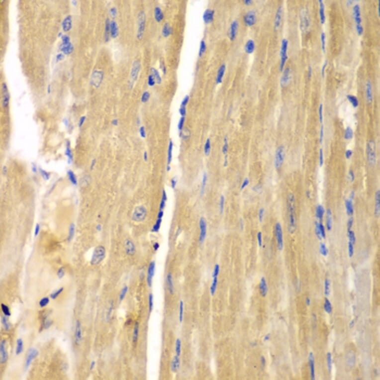 Immunohistochemistry - Anti-SLC25A13 Antibody (A5849) - Antibodies.com