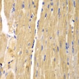 Immunohistochemistry - Anti-SLC25A13 Antibody (A5849) - Antibodies.com