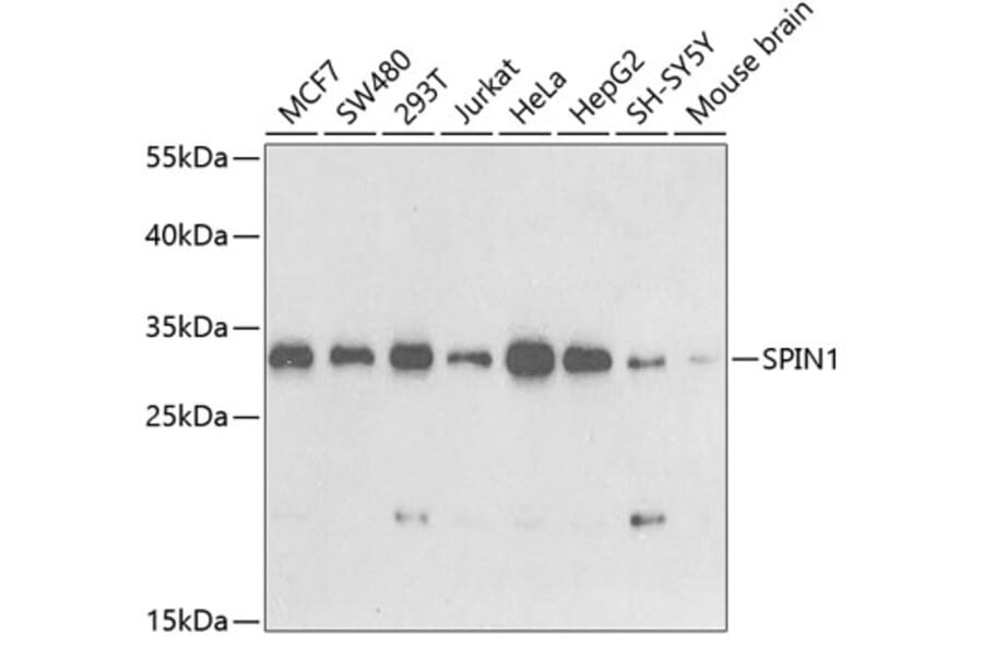 Western Blot - Anti-spindlin 1 Antibody (A15016) - Antibodies.com