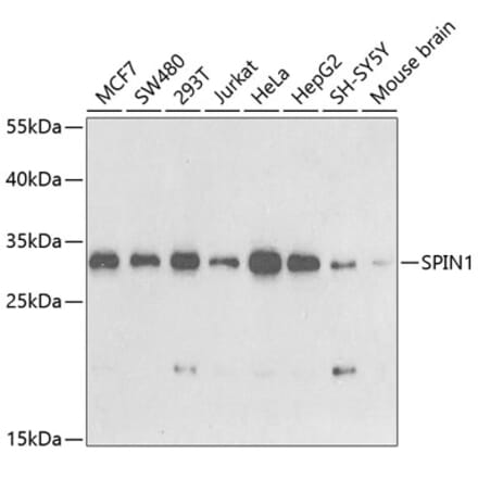 Western Blot - Anti-spindlin 1 Antibody (A15016) - Antibodies.com