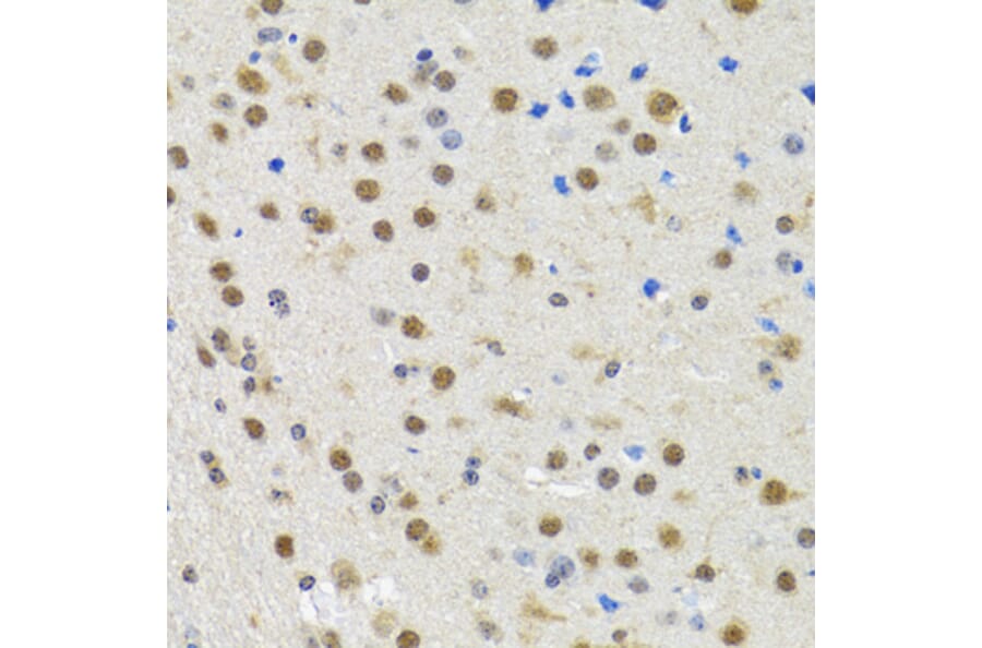 Immunohistochemistry - Anti-spindlin 1 Antibody (A15016) - Antibodies.com