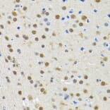 Immunohistochemistry - Anti-spindlin 1 Antibody (A15016) - Antibodies.com