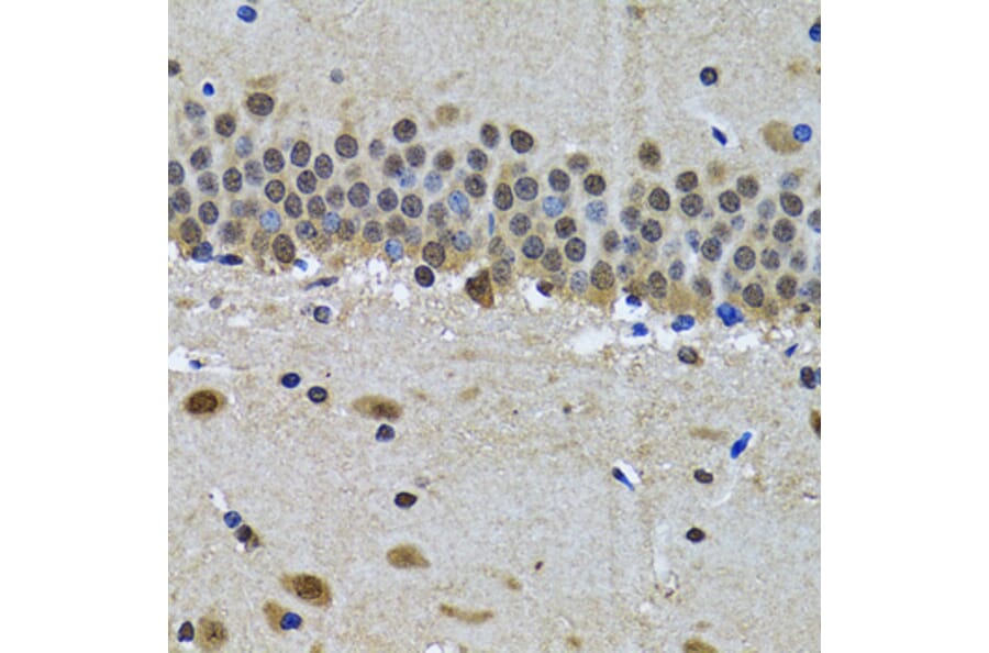 Immunohistochemistry - Anti-spindlin 1 Antibody (A15016) - Antibodies.com