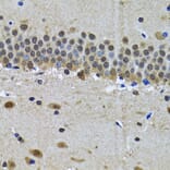 Immunohistochemistry - Anti-spindlin 1 Antibody (A15016) - Antibodies.com