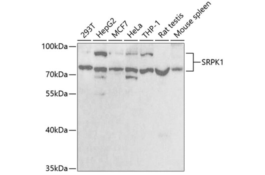 Western Blot - Anti-SRPK1 Antibody (A5854) - Antibodies.com