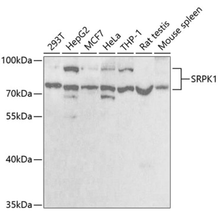 Western Blot - Anti-SRPK1 Antibody (A5854) - Antibodies.com