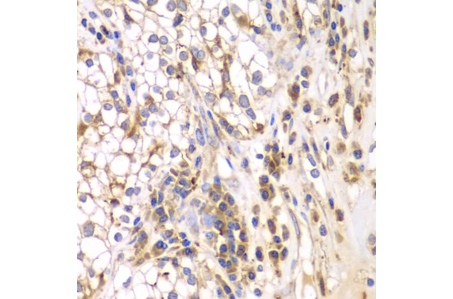 Immunohistochemistry - Anti-SRPK1 Antibody (A5854) - Antibodies.com