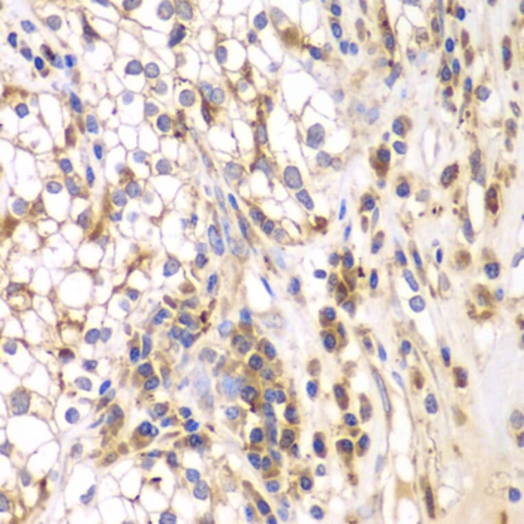 Immunohistochemistry - Anti-SRPK1 Antibody (A5854) - Antibodies.com