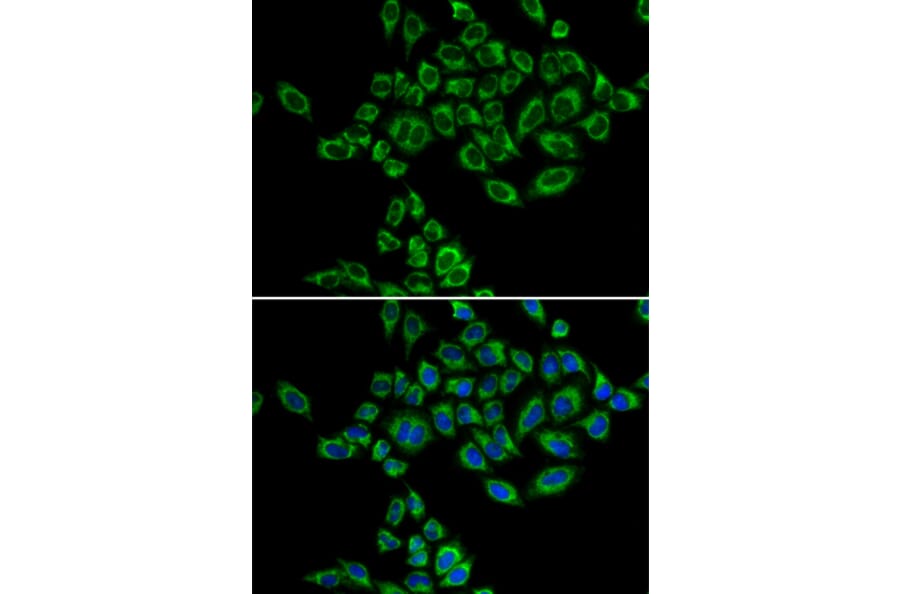 Immunofluorescence - Anti-SRPK1 Antibody (A5854) - Antibodies.com