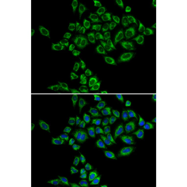 Immunofluorescence - Anti-SRPK1 Antibody (A5854) - Antibodies.com