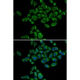 Immunofluorescence - Anti-SRPK1 Antibody (A5854) - Antibodies.com