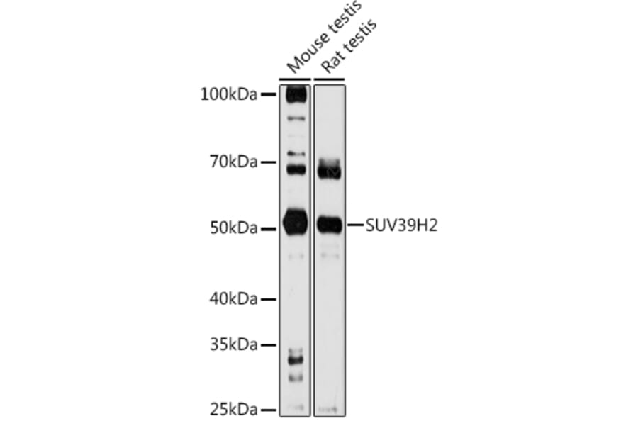 Western Blot - Anti-KMT1B/SUV39H2 Antibody (A15018) - Antibodies.com