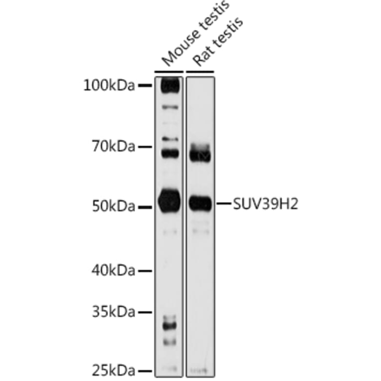 Western Blot - Anti-KMT1B/SUV39H2 Antibody (A15018) - Antibodies.com
