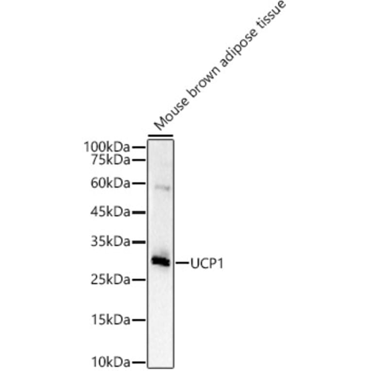 Western Blot - Anti-UCP1 Antibody (A15019) - Antibodies.com