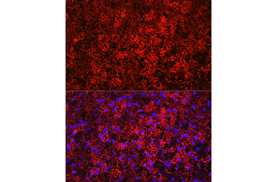 Anti-UCP1 Antibody (A15019) IHC