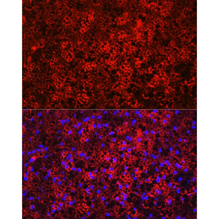 Immunofluorescence - Anti-UCP1 Antibody (A15019) - Antibodies.com
