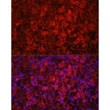 Immunofluorescence - Anti-UCP1 Antibody (A15019) - Antibodies.com
