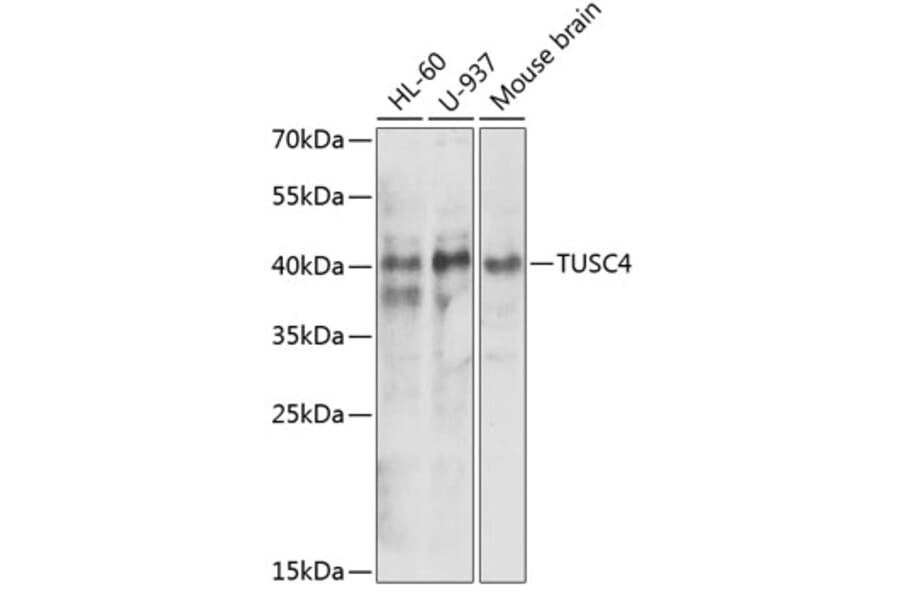 Western Blot - Anti-NPRL2 Antibody (A15020) - Antibodies.com
