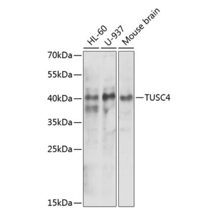 Western Blot - Anti-NPRL2 Antibody (A15020) - Antibodies.com