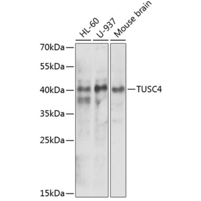 Western Blot - Anti-NPRL2 Antibody (A15020) - Antibodies.com