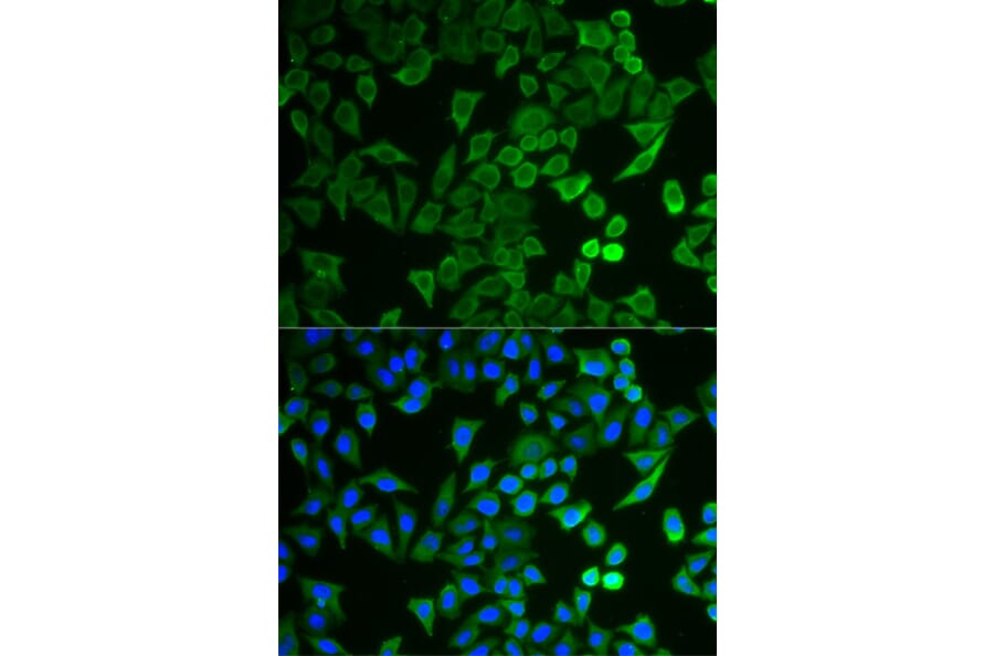 Immunofluorescence - Anti-NPRL2 Antibody (A15020) - Antibodies.com