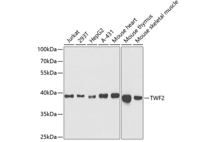Western Blot - Anti-TWF2 Antibody (A15021) - Antibodies.com