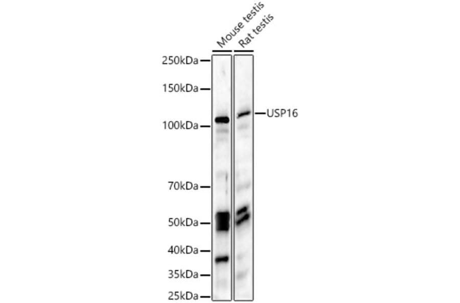 Western Blot - Anti-USP16 Antibody (A15022) - Antibodies.com