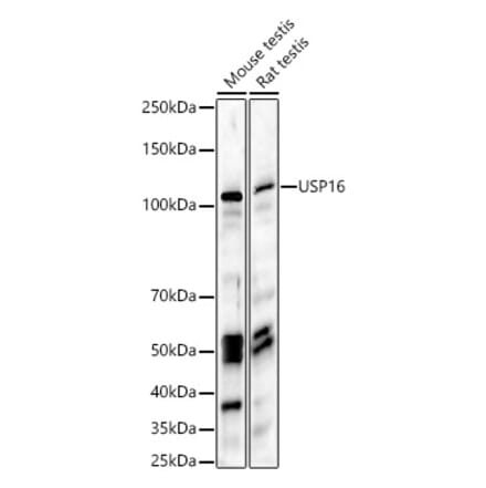 Western Blot - Anti-USP16 Antibody (A15022) - Antibodies.com