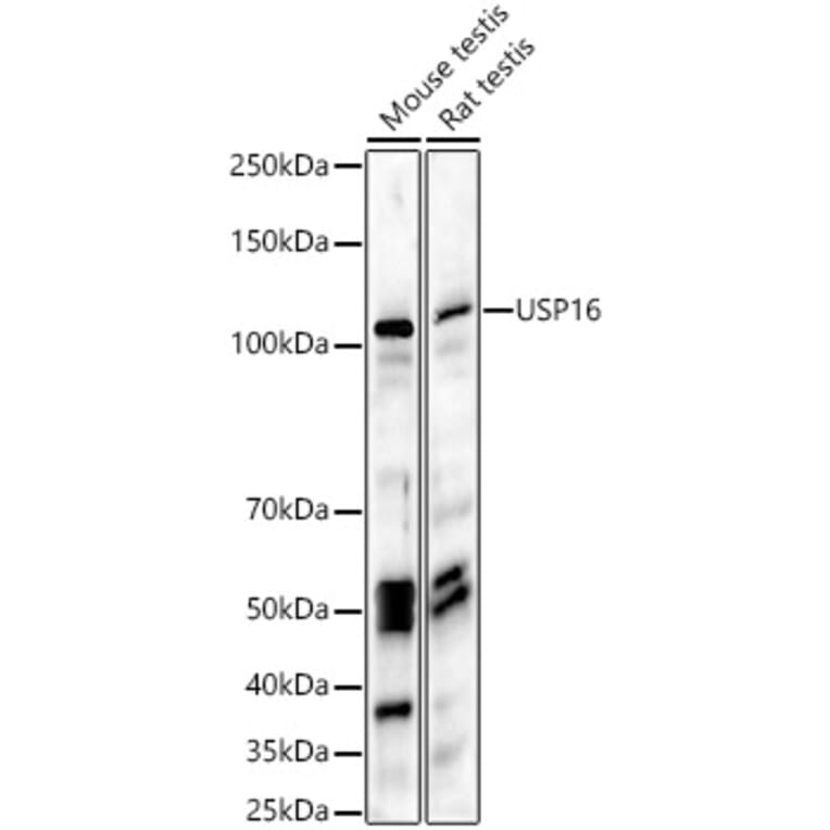 Western Blot - Anti-USP16 Antibody (A15022) - Antibodies.com