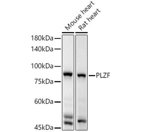 Western Blot - Anti-Plzf Antibody (A15023) - Antibodies.com
