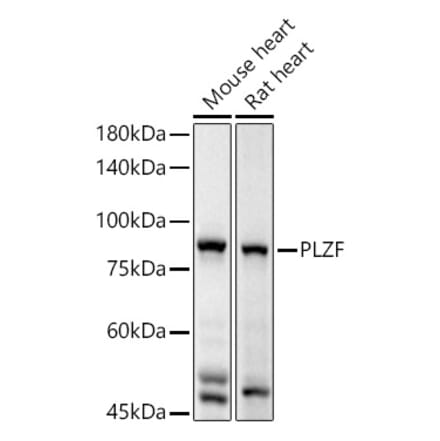 Western Blot - Anti-Plzf Antibody (A15023) - Antibodies.com