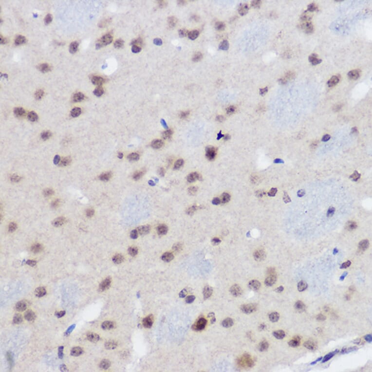 Immunohistochemistry - Anti-Plzf Antibody (A15023) - Antibodies.com
