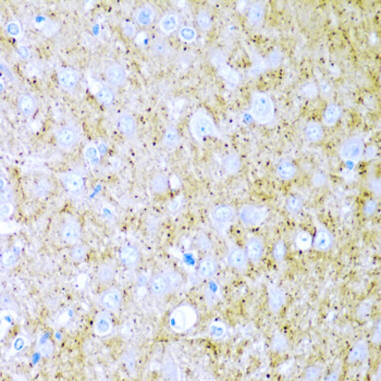 Immunohistochemistry - Anti-Wnt2/IRP Antibody (A15024) - Antibodies.com