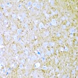 Immunohistochemistry - Anti-Wnt2/IRP Antibody (A15024) - Antibodies.com