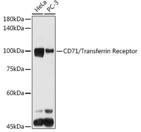 Western Blot - Anti-Transferrin Receptor Antibody (A15025) - Antibodies.com