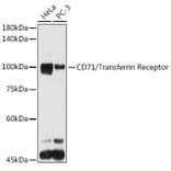 Western Blot - Anti-Transferrin Receptor Antibody (A15025) - Antibodies.com