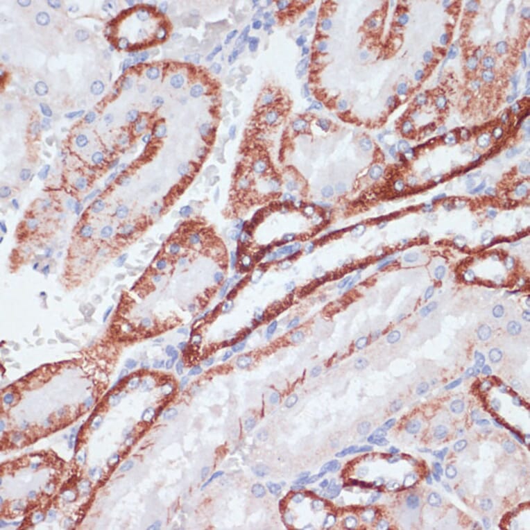 Immunohistochemistry - Anti-Transferrin Receptor Antibody (A15025) - Antibodies.com