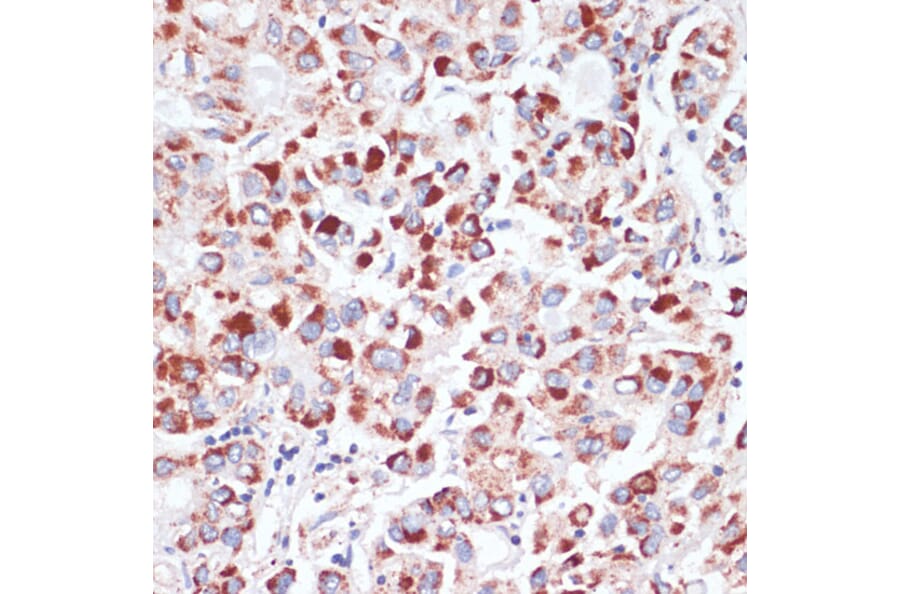 Immunohistochemistry - Anti-Transferrin Receptor Antibody (A15025) - Antibodies.com