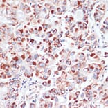 Immunohistochemistry - Anti-Transferrin Receptor Antibody (A15025) - Antibodies.com