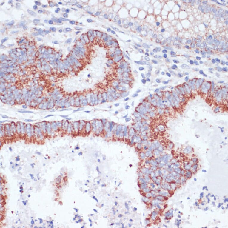 Immunohistochemistry - Anti-Transferrin Receptor Antibody (A15025) - Antibodies.com