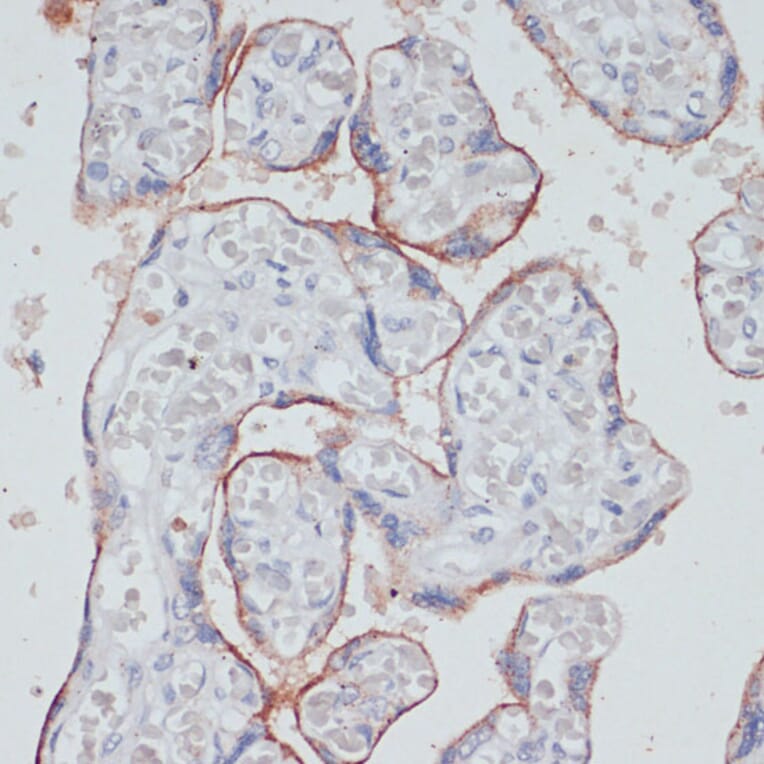 Immunohistochemistry - Anti-Transferrin Receptor Antibody (A15025) - Antibodies.com