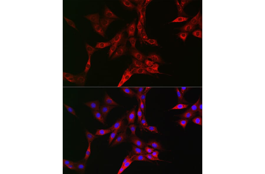 Immunofluorescence - Anti-Transferrin Receptor Antibody (A15025) - Antibodies.com