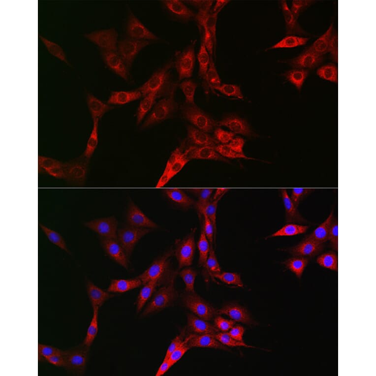 Immunofluorescence - Anti-Transferrin Receptor Antibody (A15025) - Antibodies.com