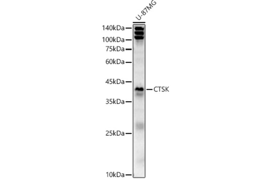 Western Blot - Anti-Cathepsin K Antibody (A15026) - Antibodies.com