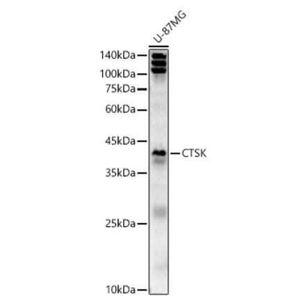 Western Blot - Anti-Cathepsin K Antibody (A15026) - Antibodies.com