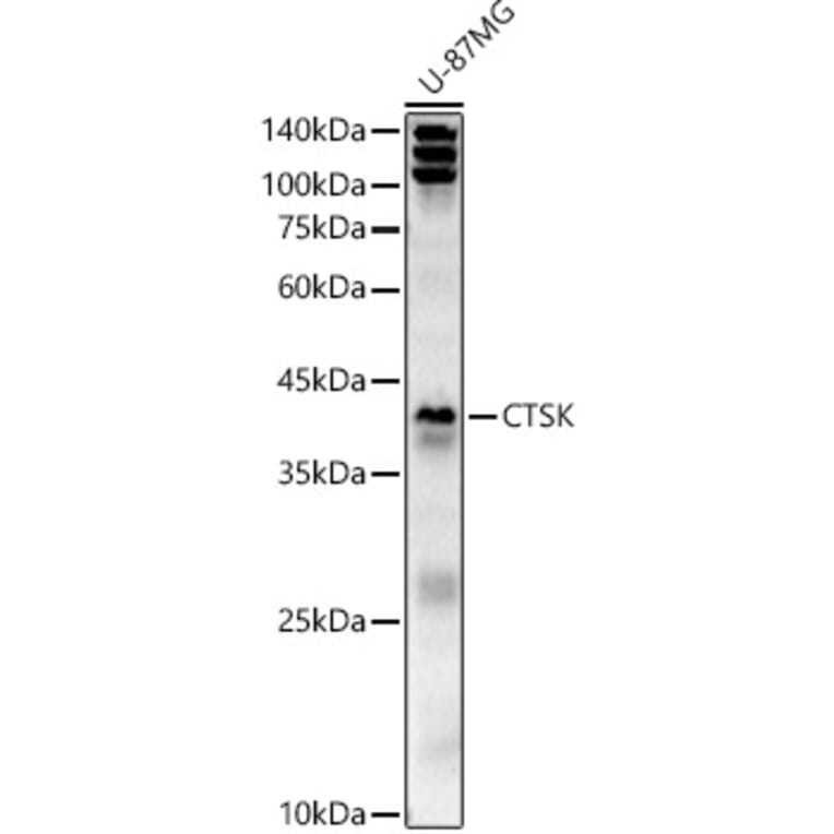 Western Blot - Anti-Cathepsin K Antibody (A15026) - Antibodies.com