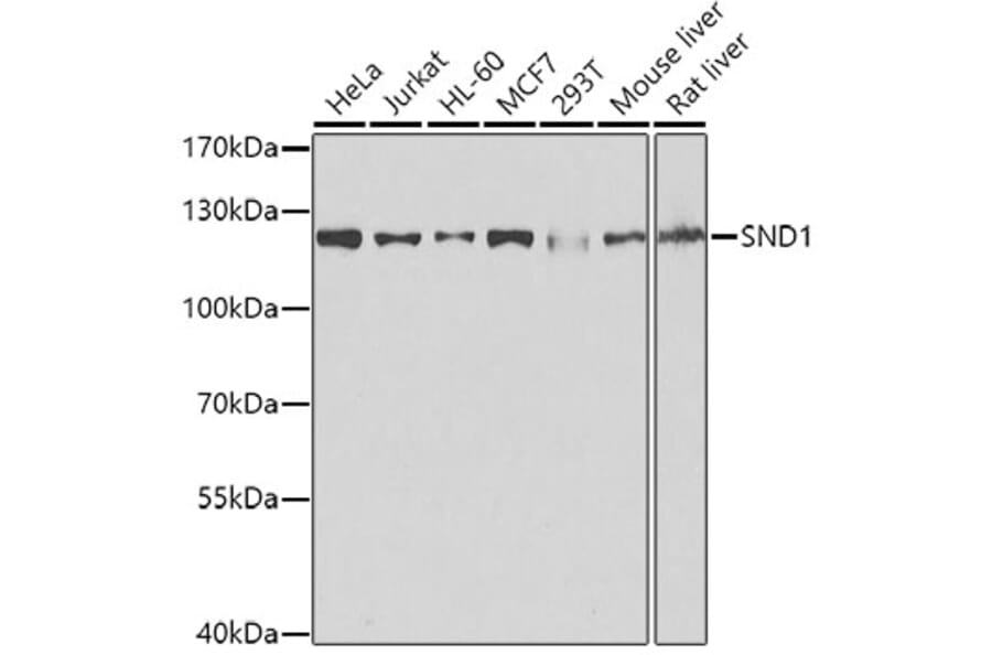 Western Blot - Anti-SND1 Antibody (A15028) - Antibodies.com
