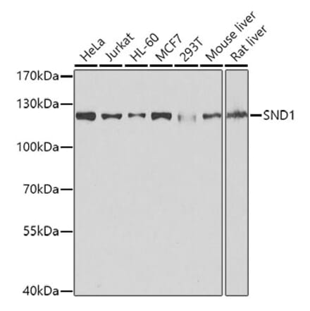 Western Blot - Anti-SND1 Antibody (A15028) - Antibodies.com