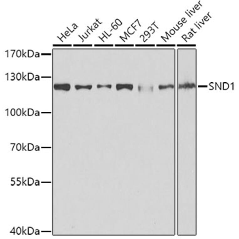 Western Blot - Anti-SND1 Antibody (A15028) - Antibodies.com